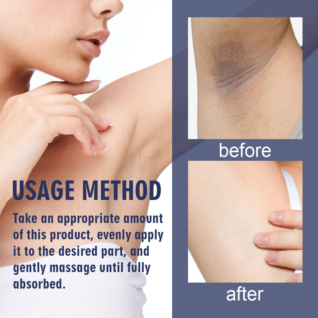 OUHOE Underarm Care Cream Knee Knuckle Elbow Armpit Dull Moisturizing Cleansing Skin Beauty Cream