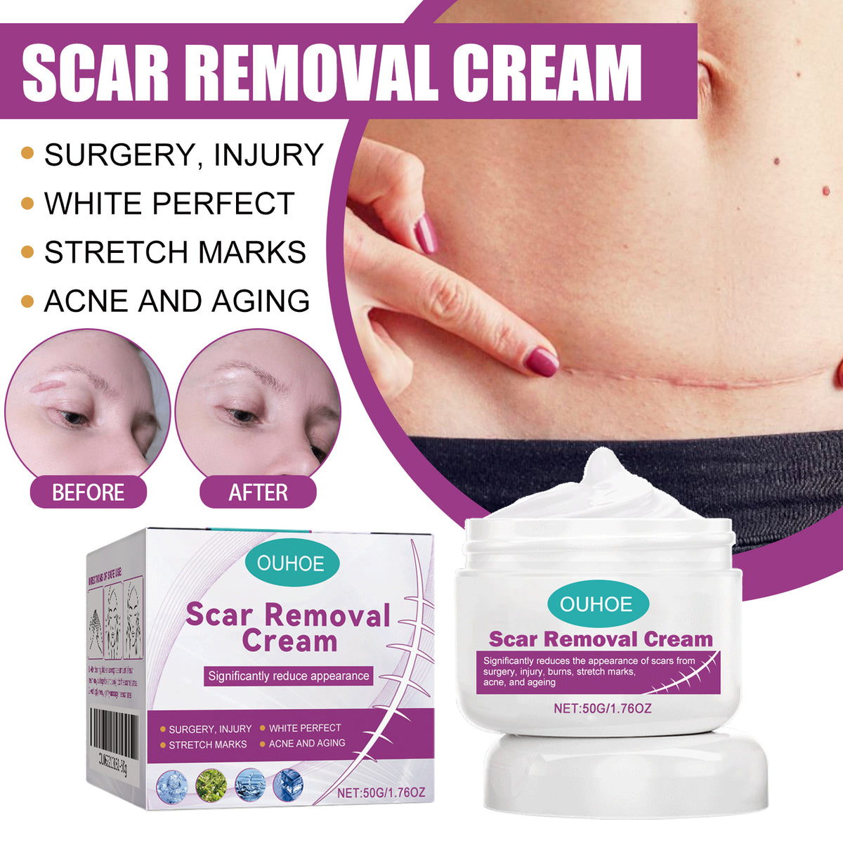 OUHOE Skin Care Cream Gently Nourishes And Lubricates Improving Skin Daily Care Facial Body Care Cream