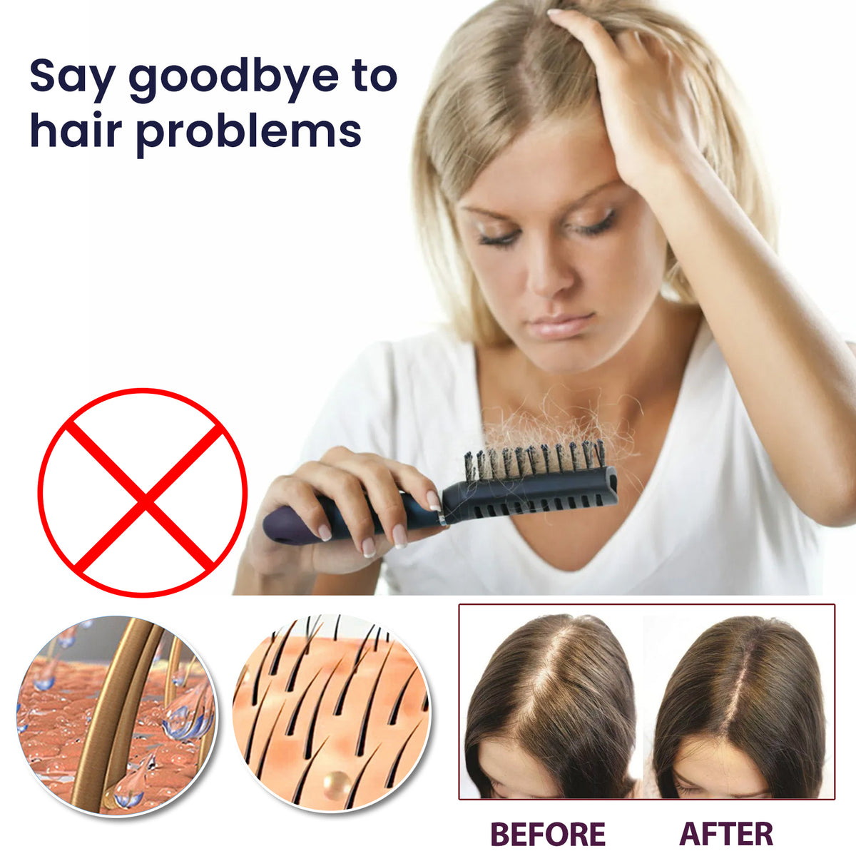 OUHOE Hair Treatment Spray Strengthens Hair, Moisturizes Hair, Improves Dry And Irritated Hair And Hydrates Hair Treatment Spray